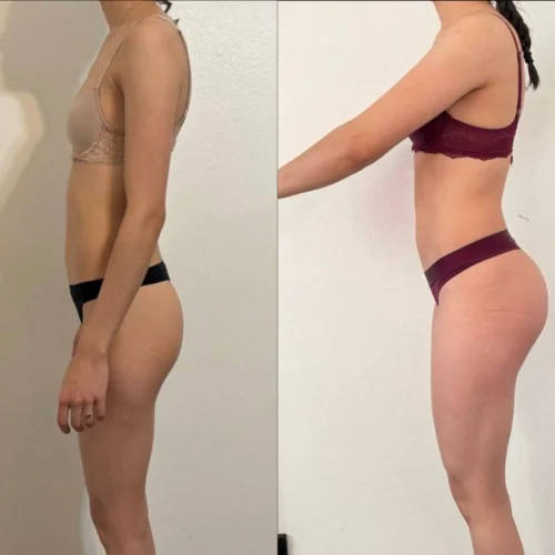 3969940b_2f6a_4704_be7a_e5a68282f9c8_1_1x